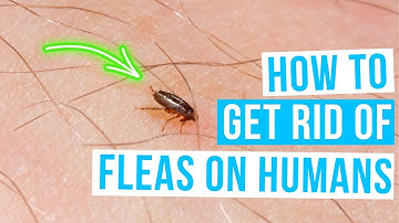 How to GET RID OF FLEAS ON HUMANS