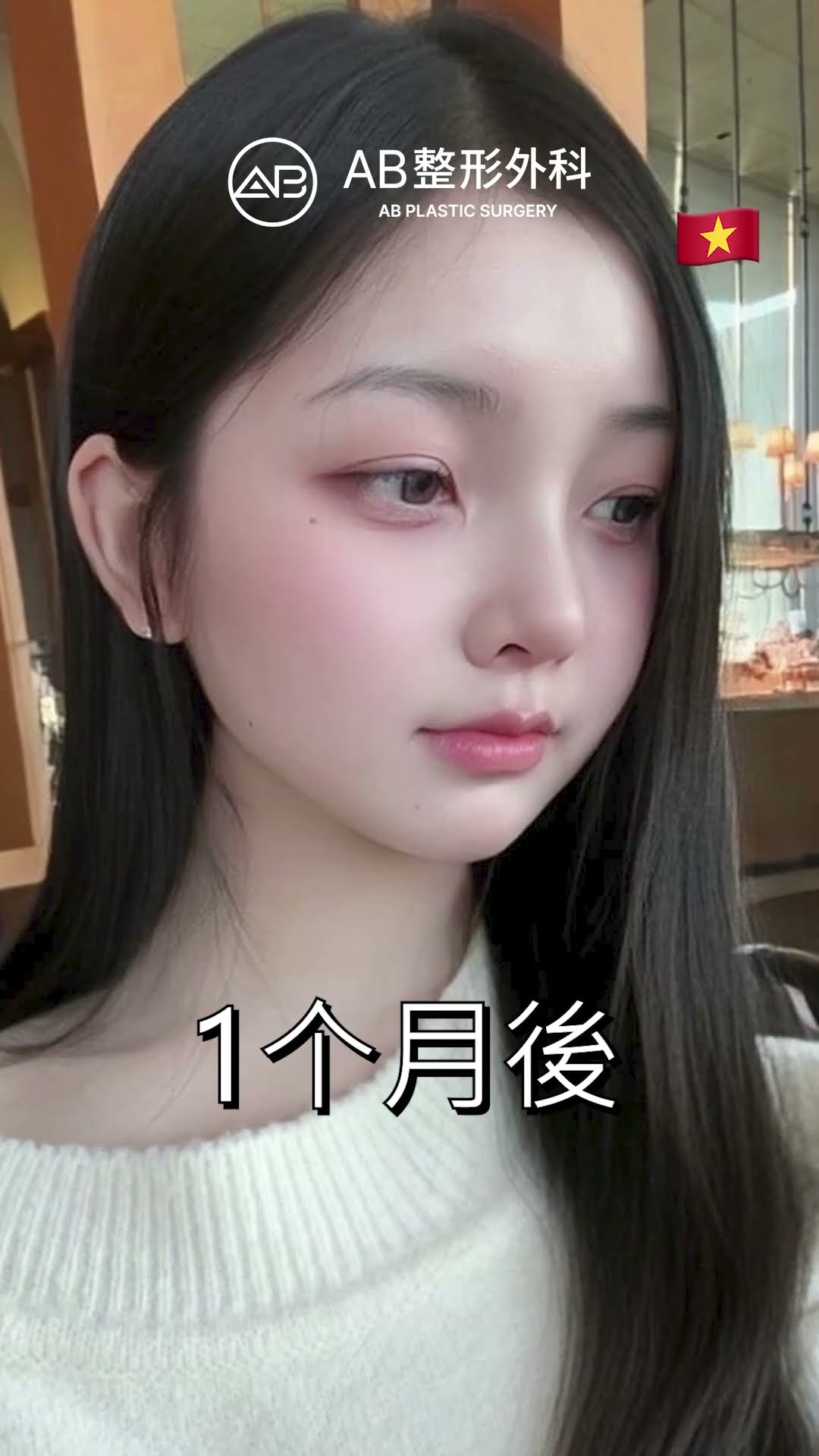 蒜頭鼻變可愛精緻鼻型 #shorts