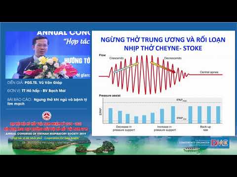Ngừng thở khi ngủ và các bệnh tim mạch