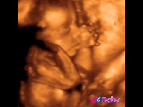 UC BABY - Example 4D ultrasound scan #73