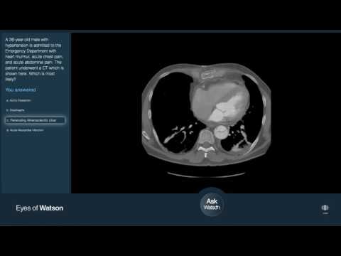 IBM Research – Cognitive Computing & Radiology for Heart Disease