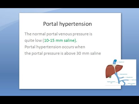Pathology 632 a Portal Hypertension Cause Complication Esophagial varice Caput medusae Budd chiari