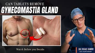 Can Medicine Treat Gynecomastia? Honest Answer | Ludhiana Punjab