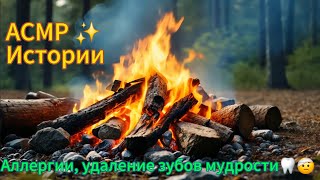 видео: АСМР болталка | Мои новые аллергии, об удалениях зубах мудрости | иголочки и царапанье ветрозащиты | картинка: АСМР болталка | Мои новые аллергии, об удалениях зубах мудрости | иголочки и царапанье ветрозащиты |