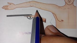 supracondylar Fracture of the Humerus (part-2)