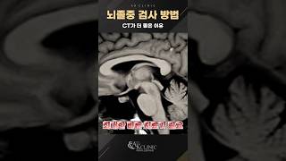 뇌졸중, CT 검사 먼저 하는 이유! 응급 진단 핵심