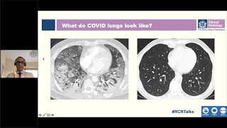Unmasking the true face of COVID-19 through clinical imaging
