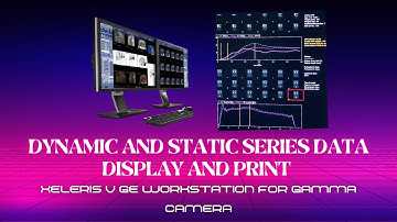 How to Display & Print Dynamic/Static Series in Xeleris V for Gamma Camera