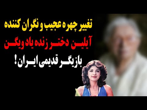 تغییر چهره شوکه کننده آیلین ویگن که باور نمیکنید یکدفعه چقدر پیر شد 