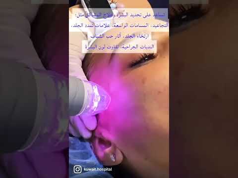 جددي شباب بشرتك الآن مع تقنية فيفاشي الحديثة