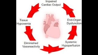 Human Anatomy &amp; Physiology; The cardiovascular system; Shock : - 55. #shock #heart #neet #blood