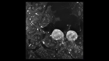 STEM CELLS: Long Term Live Imaging of Mouse Embryonic Stem Cells for 9,5 + 48 hours!