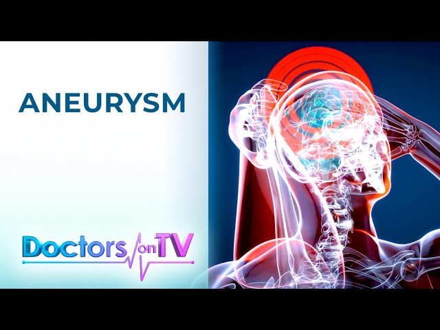 ANEURYSM: Causes, Symptoms, Treatment, and Prevention | DOCTORS on TV class=