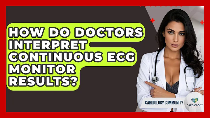 How Do Doctors Interpret Continuous ECG Monitor Results? - Cardiology Community
