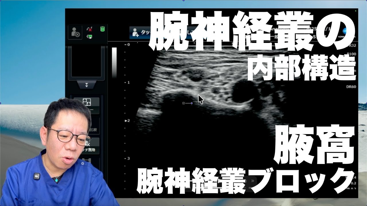 腕神経叢の内部構造（斜角筋腕神経叢ブロック）
