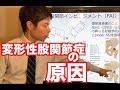 【痛みの原因！】変形性股関節症の原因・股関節痛の理由