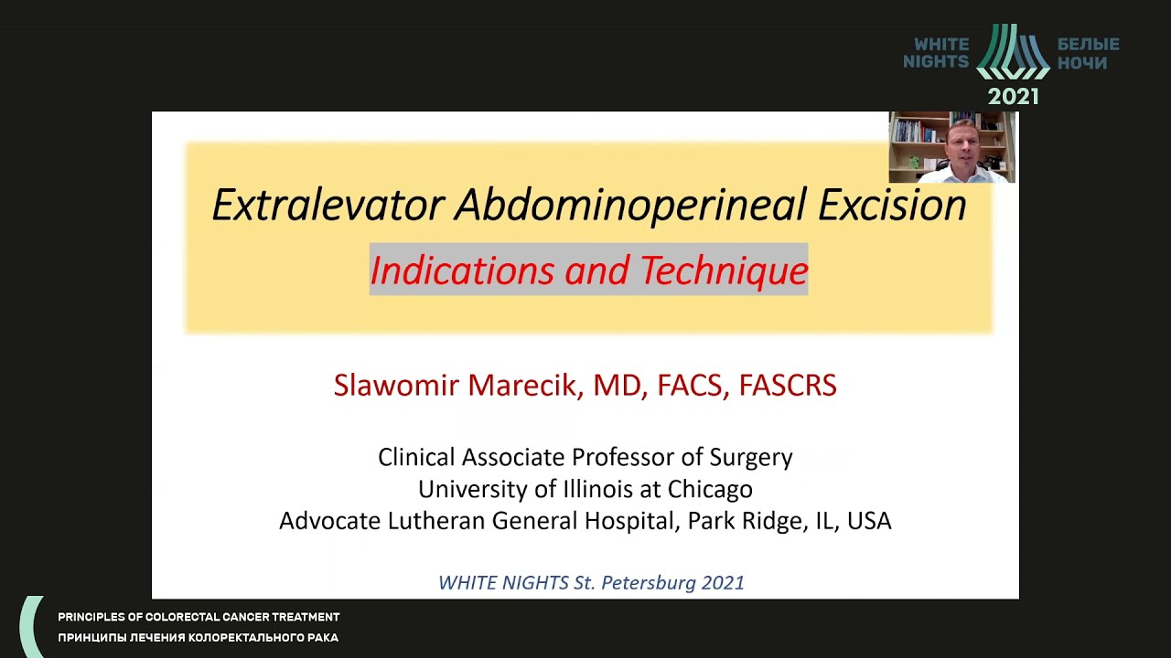 Экстралеваторная экстирпация прямой кишки: показания и техника (Slawomir Marecik)