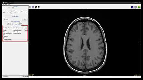 Analyze 14.0 - Measure: Sample Traces