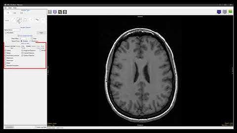Analyze 14.0 - Measure: Sample Traces