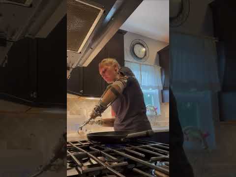 Cooking scrambled eggs with two body-powered prosthetic hooks