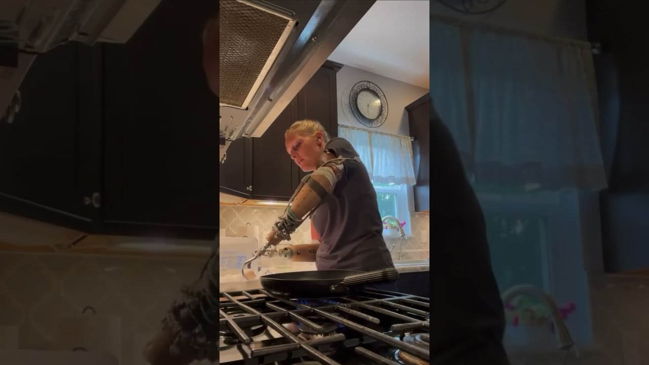 Cooking scrambled eggs with two body-powered prosthetic hooks