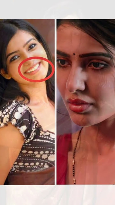 This is all the Plastic SURGERY Samantha Ruth Prabhu has had💉😳 #trending