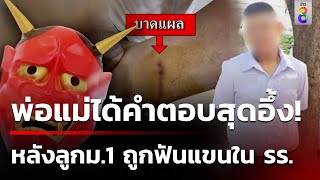 พ่อร้องลูกชายเพิ่งเข้า ม.1 ถูกฟันแขนใน รร. | 21 พ.ค. 67 | ข่าวใหญ่ช่อง8