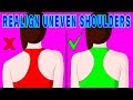 How to fix uneven shoulders naturally! - The Natural Method