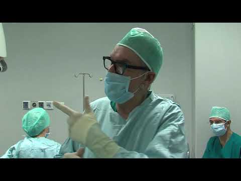 Video: Utero Settato: Come Influisce Sulla Gravidanza, Dettagli Sulla Chirurgia