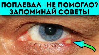 Почему врачи нам выписывают мази, а сами лечат ячмень этими народными средствами...