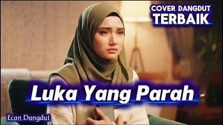 Download Lagu Luka Yang Parah - Mansur S - Cover Dangdut Terbaik - Ecan Dangdut MP3