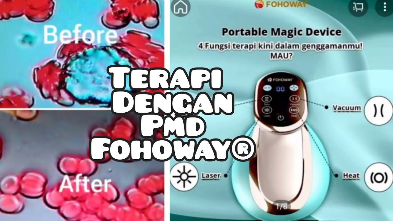 Terapi Fohoway Darah bermasalah dan darah normal setelah terapi dengan PMD FOHOWAY ...