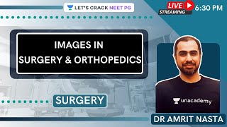 Images in Surgery & Orthopedics | Surgery for Medical PG/NEET PG/NEXT | Dr Amrit Nasta screenshot 1