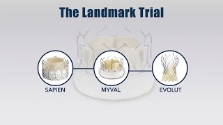 LANDMARK trial: Early outcomes of a randomised non-inferiority trial comparing TAVI devices