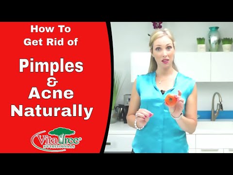 Rosacea : How to Get Rid of Pimples Naturally : VitaLife Show Ep 