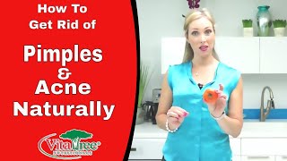 Rosacea : How to Get Rid of Pimples Naturally : VitaLife Show Ep 160