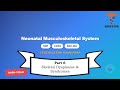 Neonatal Nursing Certification Review: Section 3 Musculoskeletal System 6/6
