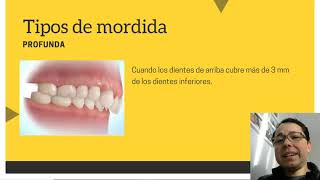 #6 clase online oclusión