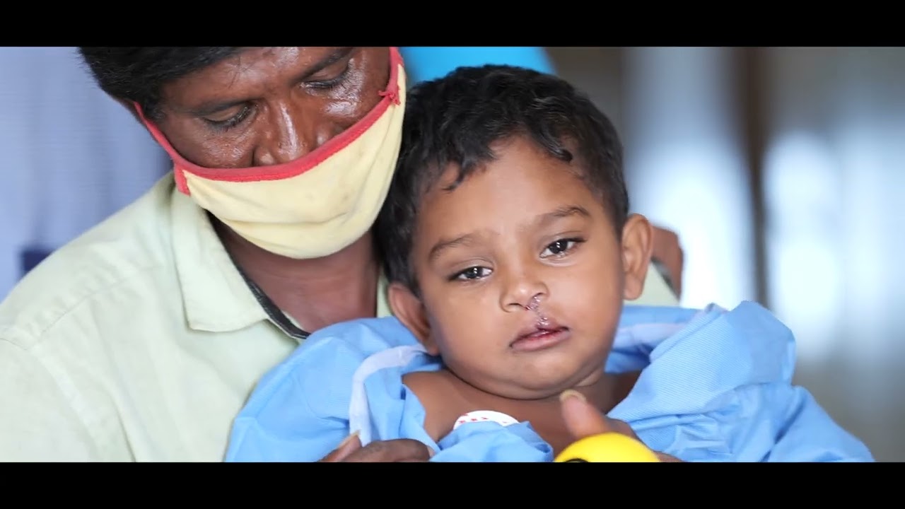 Operation Smile Case study (CSR)