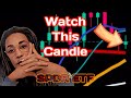 I make money in the first 10 minutes trading SPDR S&P 500 ETF Trust (SPY) | OPTIONS TRADING