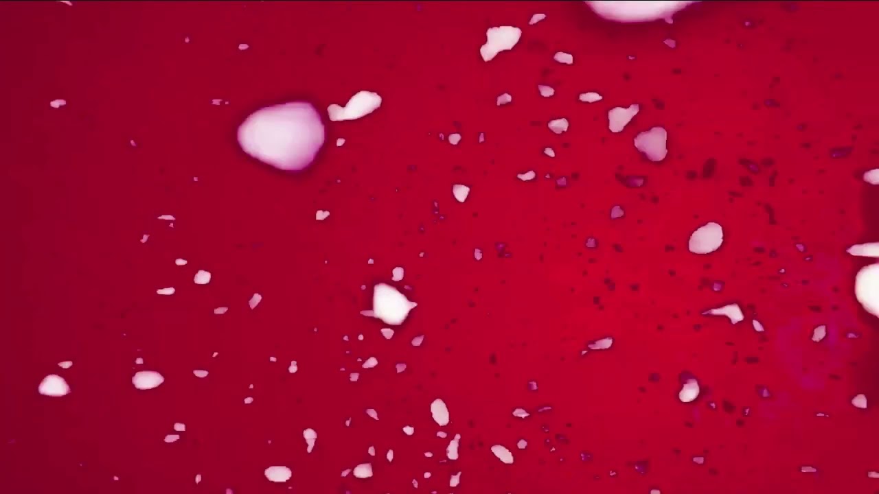 Cortexmaltex - Waterfall || Arnodd Remix (Traum V265)