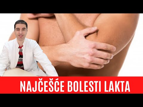 Video: Zašto Boli Lakat - Mogući Uzroci, Dijagnoza, Liječenje