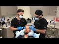 FUE Hair Transplant Surgery in Los Angeles Best FUE Hair Restoration in LA Beverly Hills California