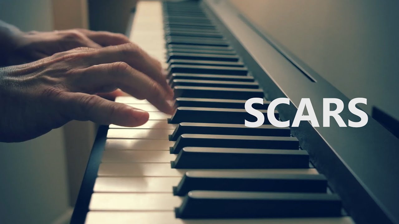 Yannis Kazakos - Scars