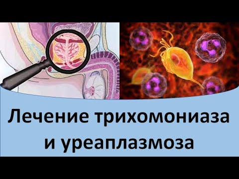 Лечение трихомониаза и уреаплазмоза