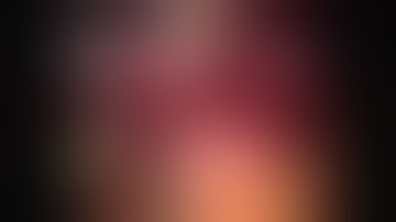 Robotic Single Site Cholecystectomy