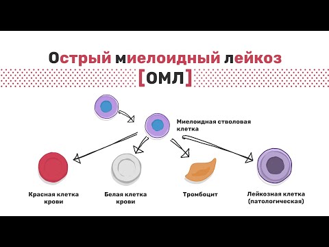 Типы острого миелоидного лейкоза