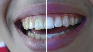 how to whiten teeth | photoshop tutorial