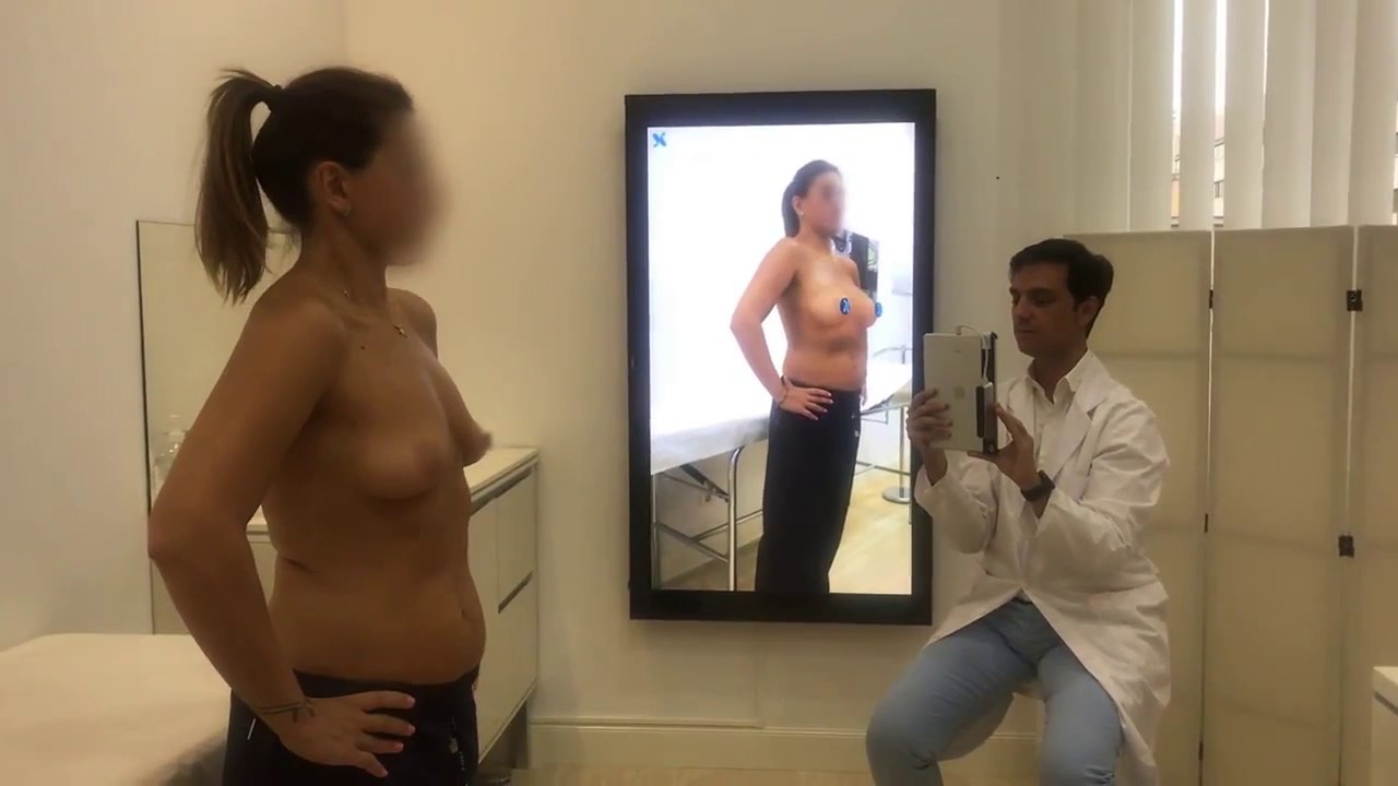 Simulación 4D de un aumento de pecho en la consulta del Dr. Gustavo Sordo