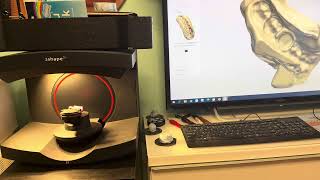 3shape scanner posterior impression scan